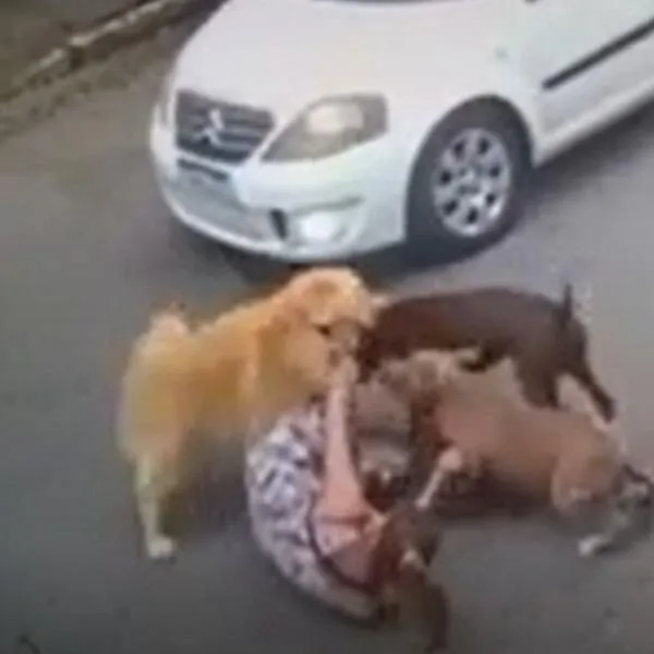 Mujer con 7 meses de embarazo tuvo caída por defender a su perro de pitbulls