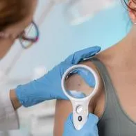 Médica inspeccionando piel de paciente, en nota sobre síntomas del cáncer de melanoma
