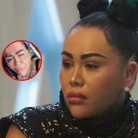 Yina Calderón mostró impactantes imagenes de su operación de biopolímeros