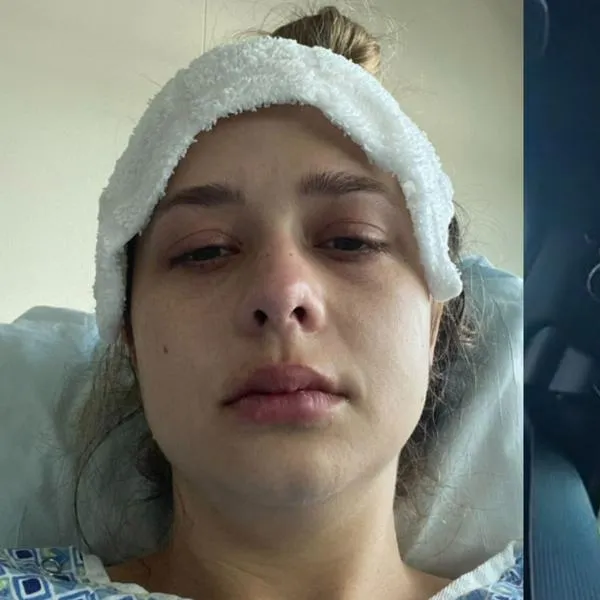 Mujer eructaba varias veces al día y el médico le dijo que era cáncer de colon