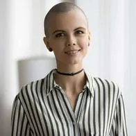 Foto de mujer si cabello, en nota de cómo recibir ayuda gratis por perdida de cabello, cejas o cicatrices en Colombia