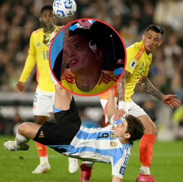 Kevin Castaño recibió golpe que le dejó herida en el Argentina vs. Colombia