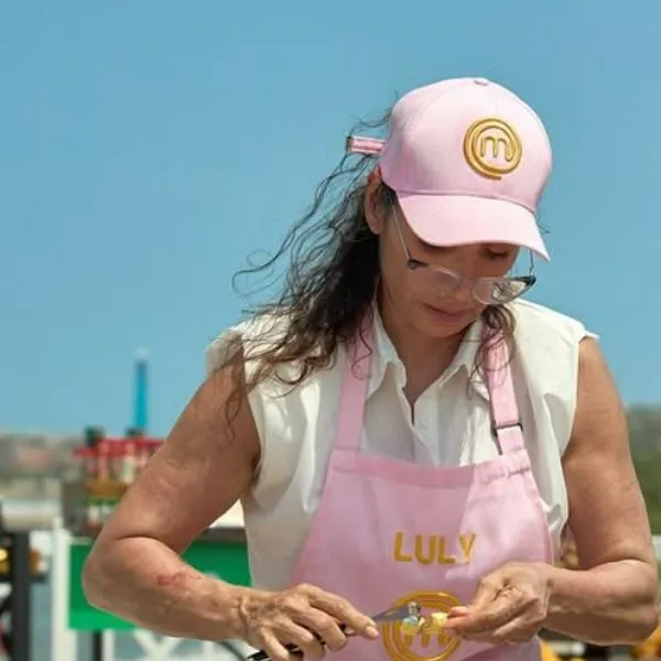 Cómo le quedó dedo a Luly Bossa luego de incidente en 'Masterchef Celebrity'