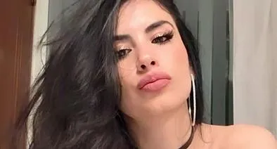 Jessica Cediel tiene la boca hinchada por culpa del rasguño de su gato