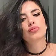 Jessica Cediel tiene la boca hinchada por culpa del rasguño de su gato