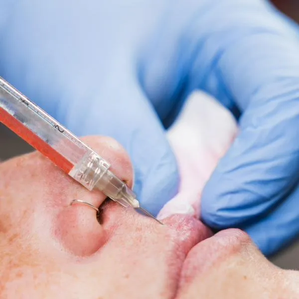 Grave denuncia de 28 mujeres luego de aplicarse bótox en estética de Inglaterra
