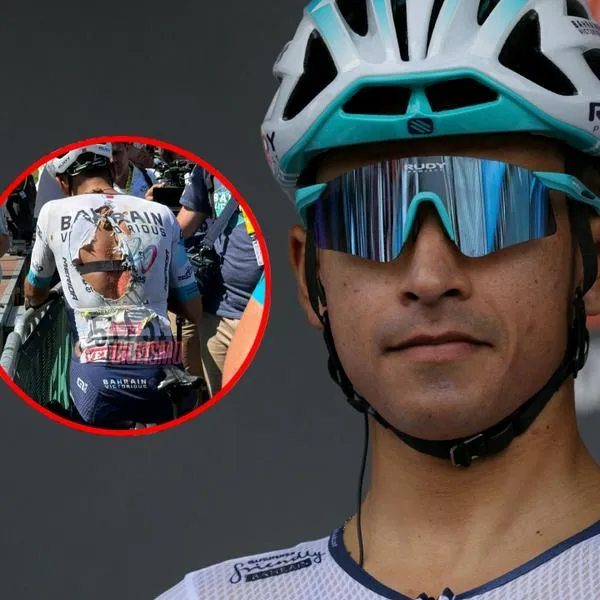 Foto de cómo quedó Santiago Buitrago por caída en Tour de Francia: raspadura