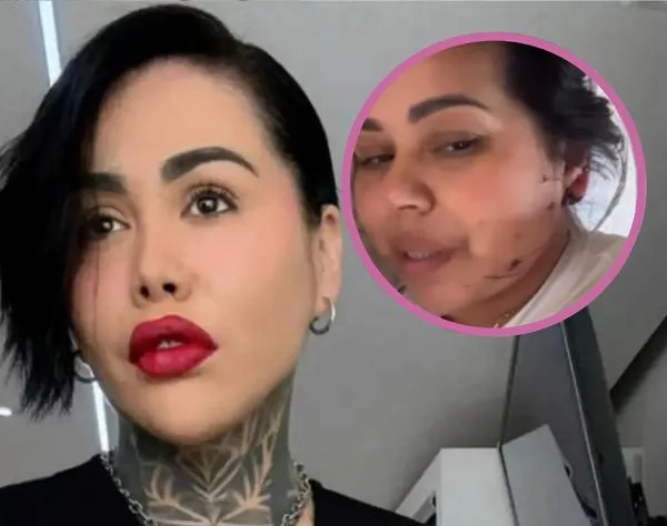 Mamá de Yina Calderón sufrió accidente de tránsito y mostró graves heridas