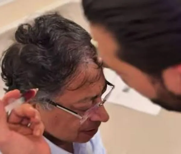 Doctor José Villafañe explicó qué inyecciones le puso a Petro en la cabeza