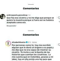 “Ten más empatía”: Elizabeth Loaiza respondió a quien criticó la cicatriz de sus glúteos 