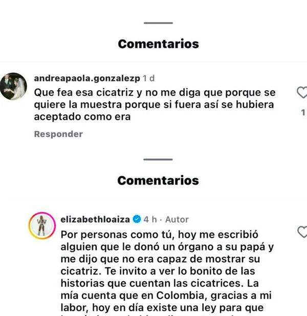 “Ten más empatía”: Elizabeth Loaiza respondió a quien criticó la cicatriz de sus glúteos 
