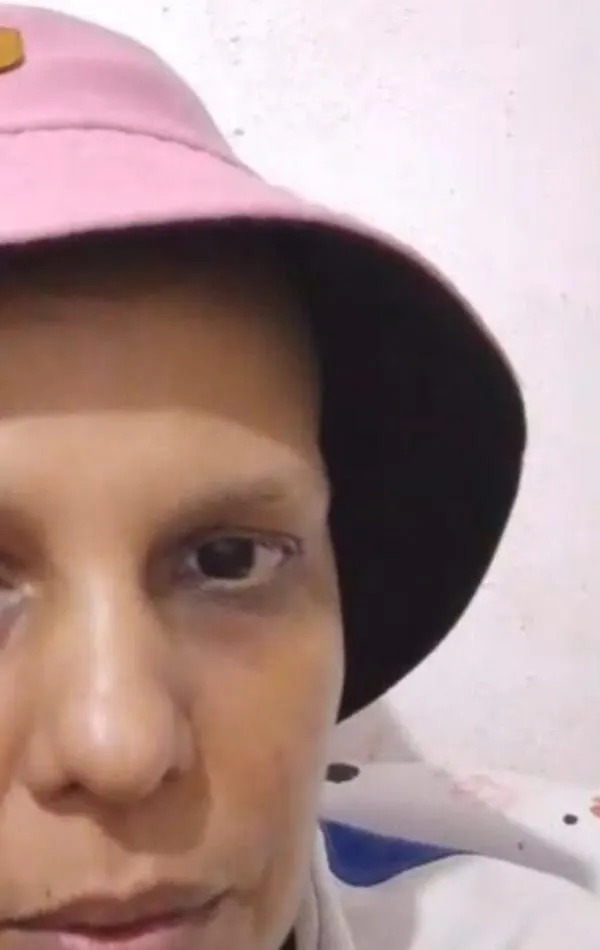 “No me dan el medicamento porque estoy muy grave”: el drama de los pacientes oncológicos de Sanitas en Valledupar