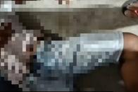 Ataque sicarial en Chiriguaná deja herido a joven de 25 años: le dejaron letrero