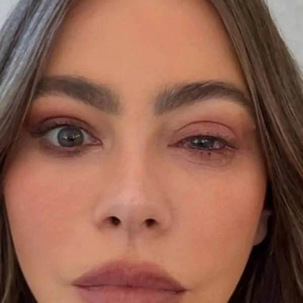 Sofía Vergara publica escalofriante foto de su ojo por un problema de salud