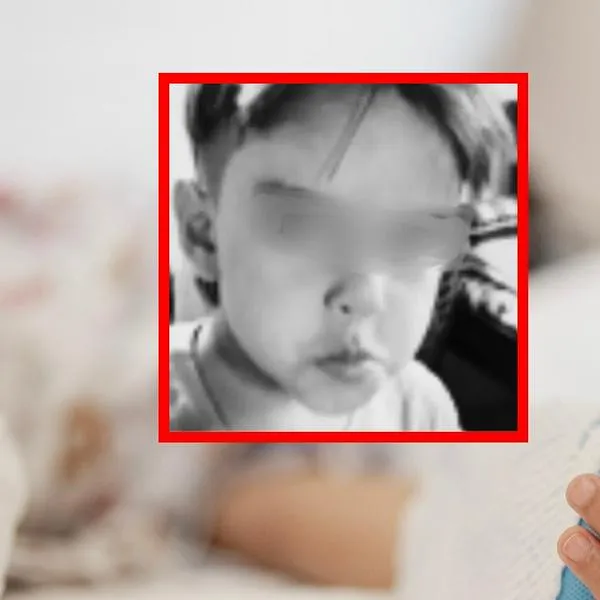 Destapan contundentes heridas que tenía niño que murió golpeado en Medellín (2)