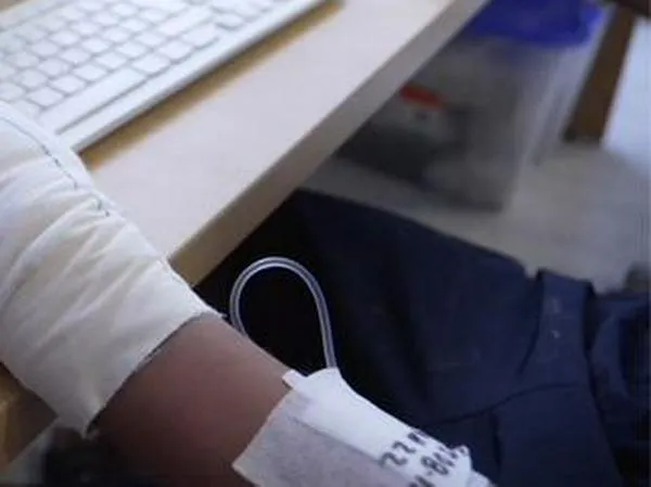 Personería de Bogotá lanzó alerta por casos de quemados tras uso de bioetanol