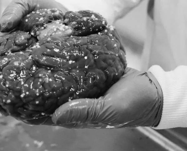Este es el programa de la Universidad de Manizales con el que podrá donar sus órganos a la ciencia