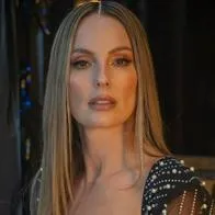 Claudia Bahamón le dio una infección en uno de sus ojos: qué le pasó 
