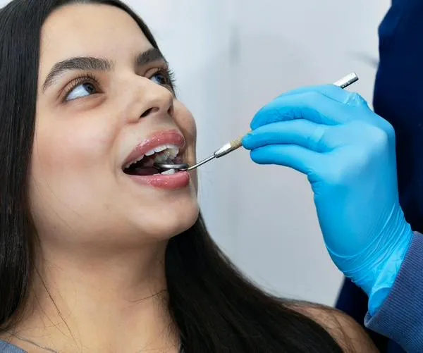 ¿Cada cuánto ir al odontólogo? La clave para prevenir caries y mantener una sonrisa sana