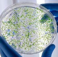 OMS advierte que las bacterias ya son inmunes a los antibióticos y preocupa