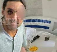 Operativo del CTI y la Sijín permite la captura de sospechoso por la brutal agresión a Tarzán en Caldas