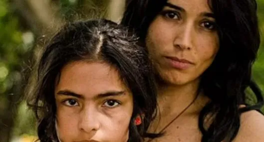 Actriz de 'Lady, la vendedora de rosas', Michelle Orozco sufre de urticaria