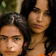 Actriz de 'Lady, la vendedora de rosas', Michelle Orozco sufre de urticaria