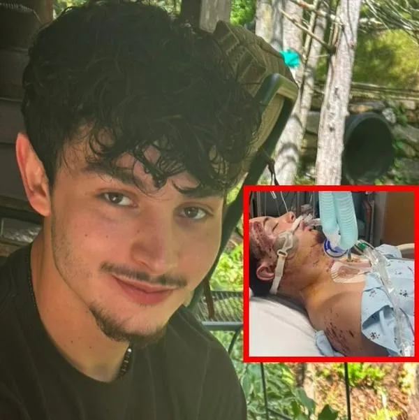 Joven despertó de coma y delató a su novia por grave accidente; luego murió