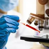 Paciente con VIH logra remisión de más de seis años sin rebote viral