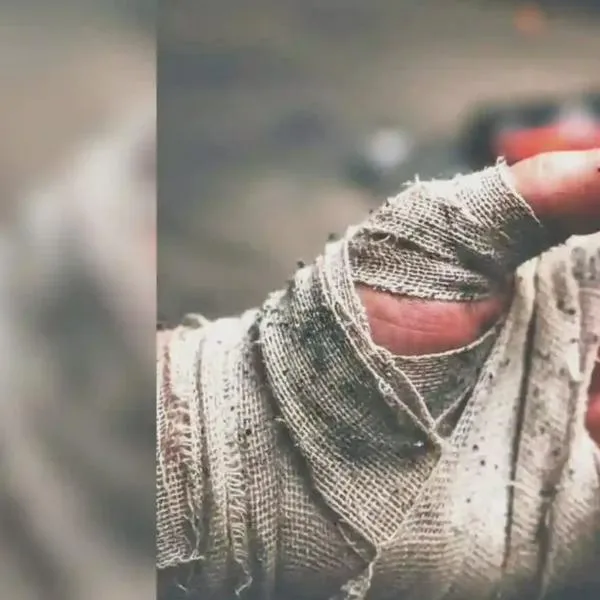 Quindío registra 13 personas quemadas con pólvora en los primeros 16 días de diciembre