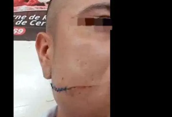 Caso en el Centrosur de Caldas: "La cárcel es lo más idóneo para evitar un feminicidio", dijo juez