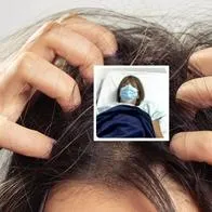 Fotos de picazón en cabeza y de Amparo Pérez, en nota de por qué Amparo Pérez, defensora de Caracol, acabó hospitalizada luego de picazón