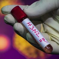 Imagen ilustrativa de Influenza A(H3N2)