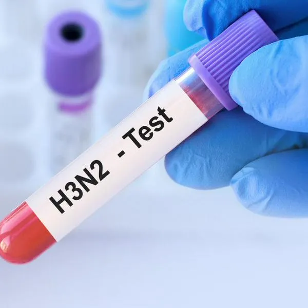 Cuáles son las diferencias entre la influenza A(H3N2) y el Covid-19 (2)