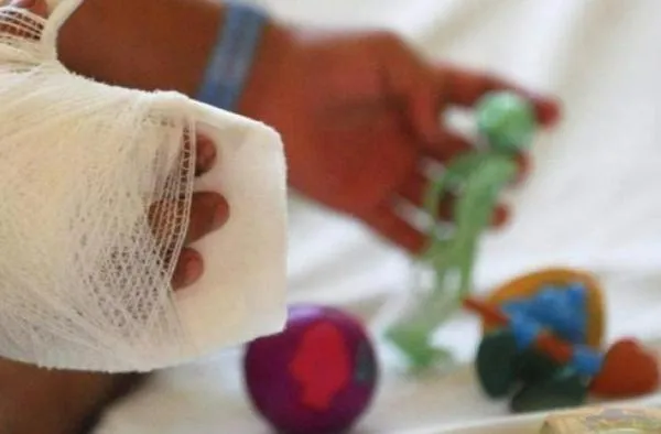 Siete quemados por pólvora se registraron en Caldas entre el 24 y 25 de diciembre: conozca dónde