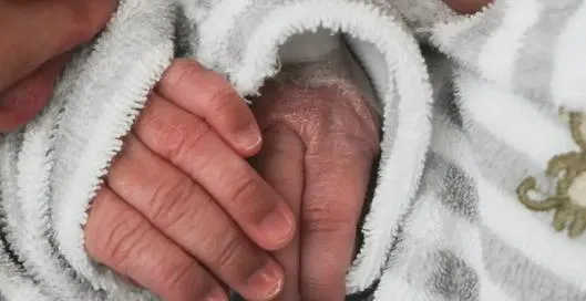 Video| Separan gemelas siamesas unidas por la columna: “un milagro de Navidad”