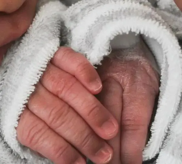 Video| Separan gemelas siamesas unidas por la columna: “un milagro de Navidad”