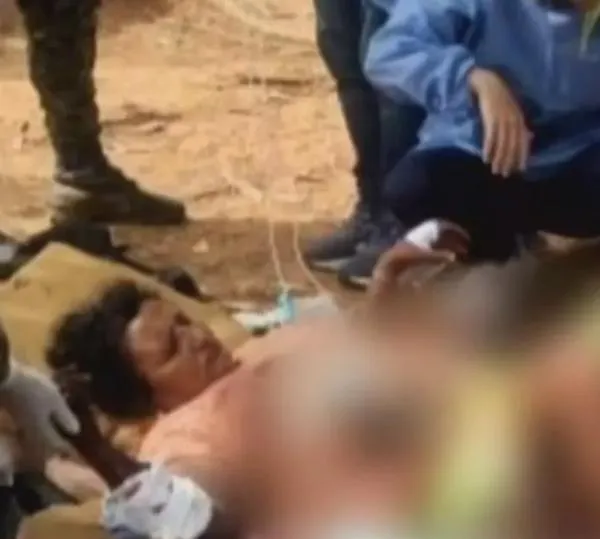 Mujer en Tibú pisó mina antipersonal frente a su casa y fue atendida por el Ejército