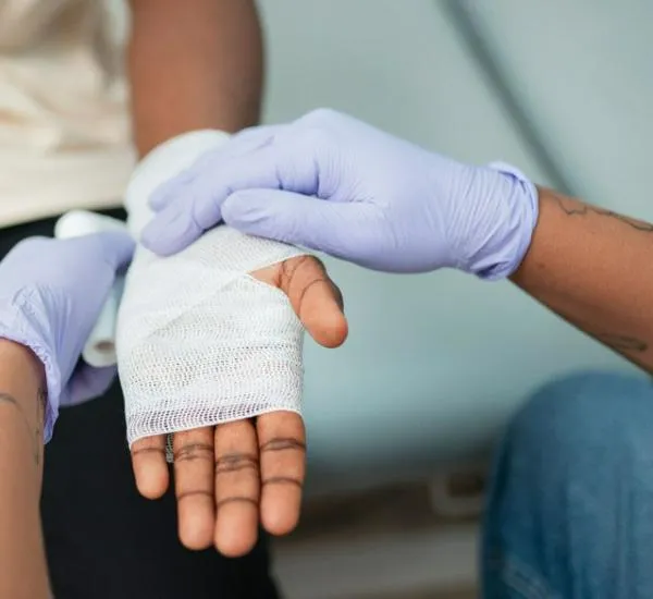 Caldas llega a 29 quemados por pólvora: aumento del 52,6% frente al 2024; tres casos nuevos