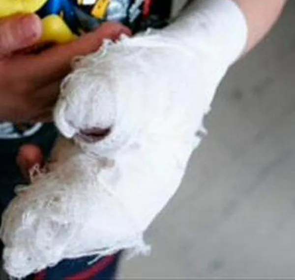 Diciembre dejó menos quemados por pólvora en Bogotá, pero preocupan casos en menores