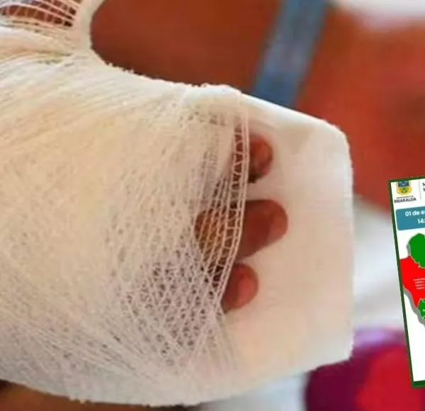 Risaralda cerró el año con 25 personas lesionadas por pólvora, entre ellas un menor de 11 años