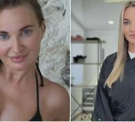 Reconocida creadora de contenido falleció tras realizarse una cirugía estética: esto se sabe