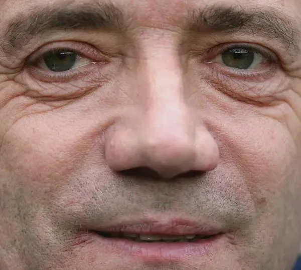 Exfutbolista y doble Balón de Oro, diagnosticado con cáncer a sus 74 años