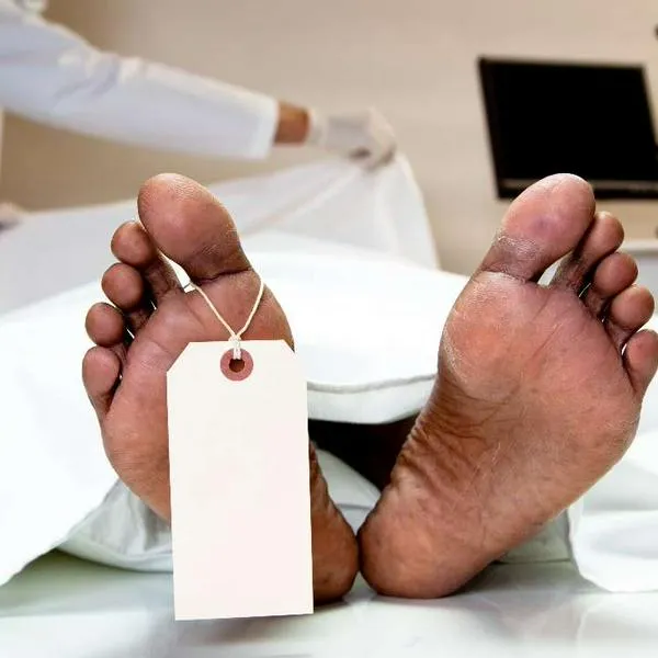 Foto de cadáver, en nota de por qué el cuerpo humano sigue vivo hasta 17 días después la muerte y su proceso