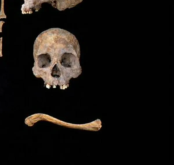 Descubren, cerca de Bogotá, la evidencia más antigua de sífilis: de hace 5.500 años