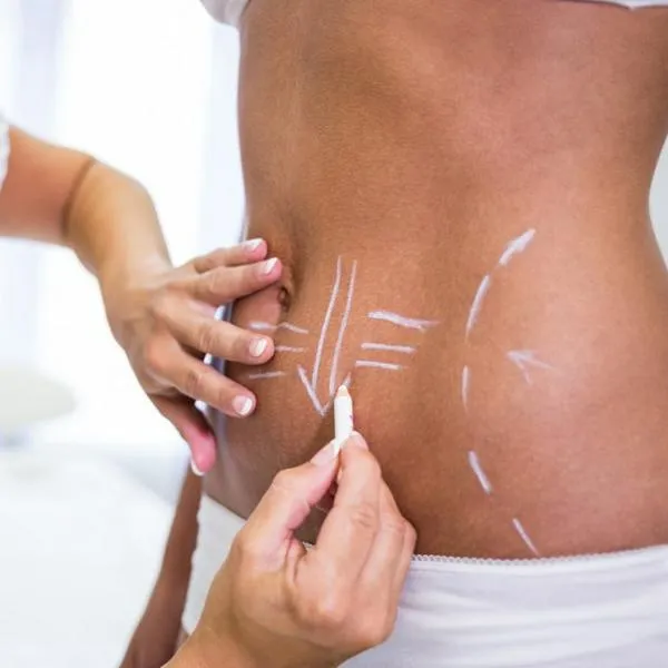 Joven está entre la vida y la muerte luego de hacerse una cirugía estética 