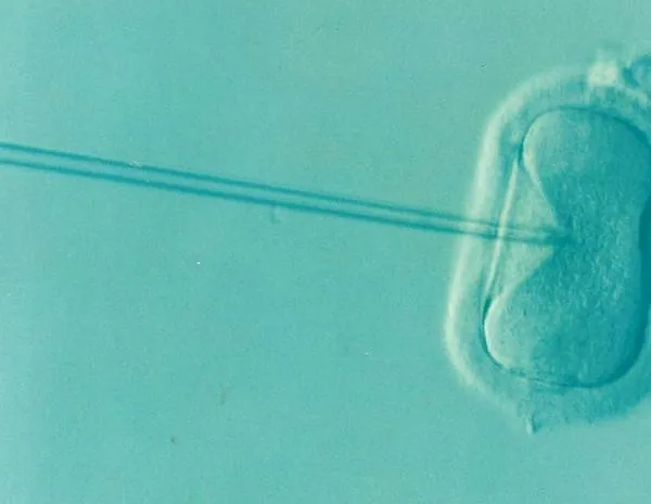 Francia: carta a los franceses de 29 años para luchar contra la infertilidad