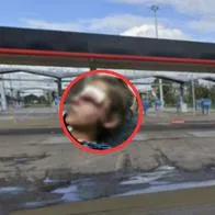 Desconocido cogió a mordiscos a niña en Bogotá y trató de incendiar carro en estación de gasolina