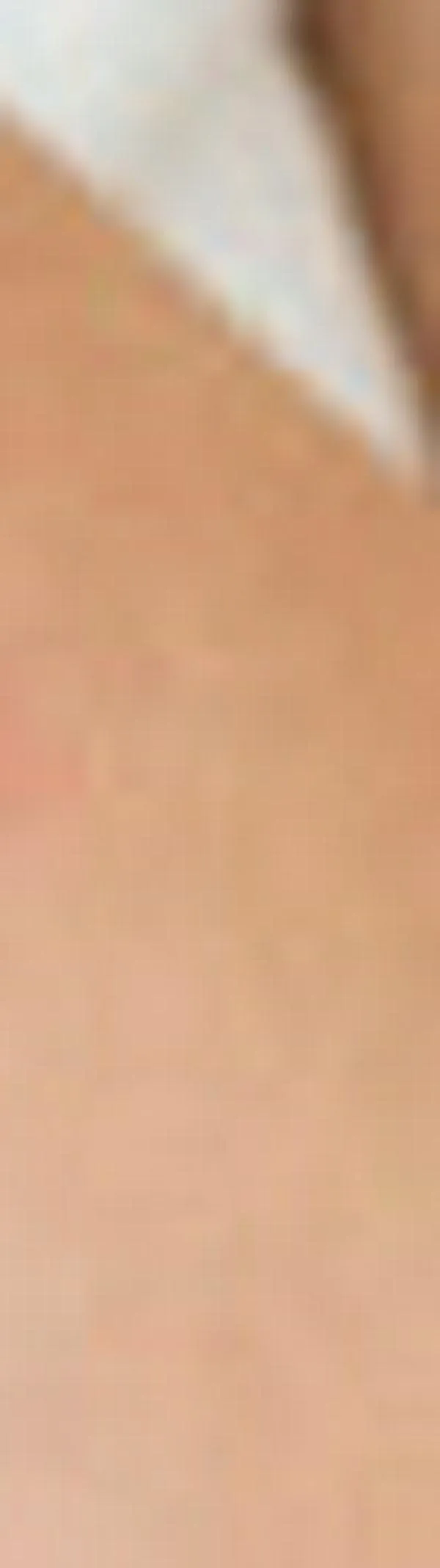 Una enfermedad crónica aumenta el riesgo de herpes zóster