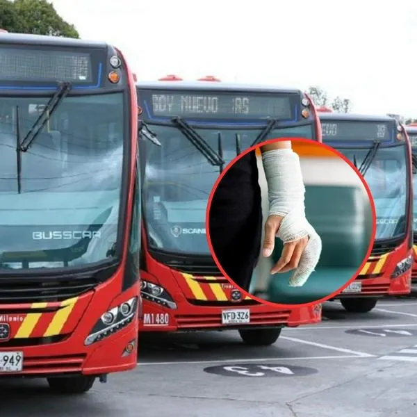 Atacaron a funcionaria de Transmilenio con químico y tiene graves quemaduras